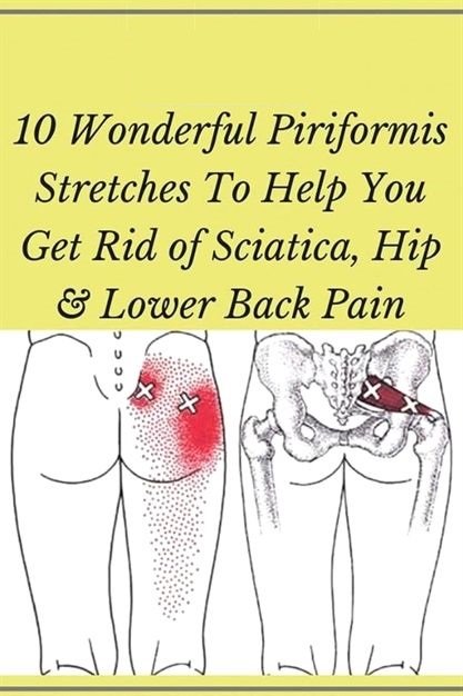 10 Piriformis Stretches To Help You Get Rid Of Sciatica ...