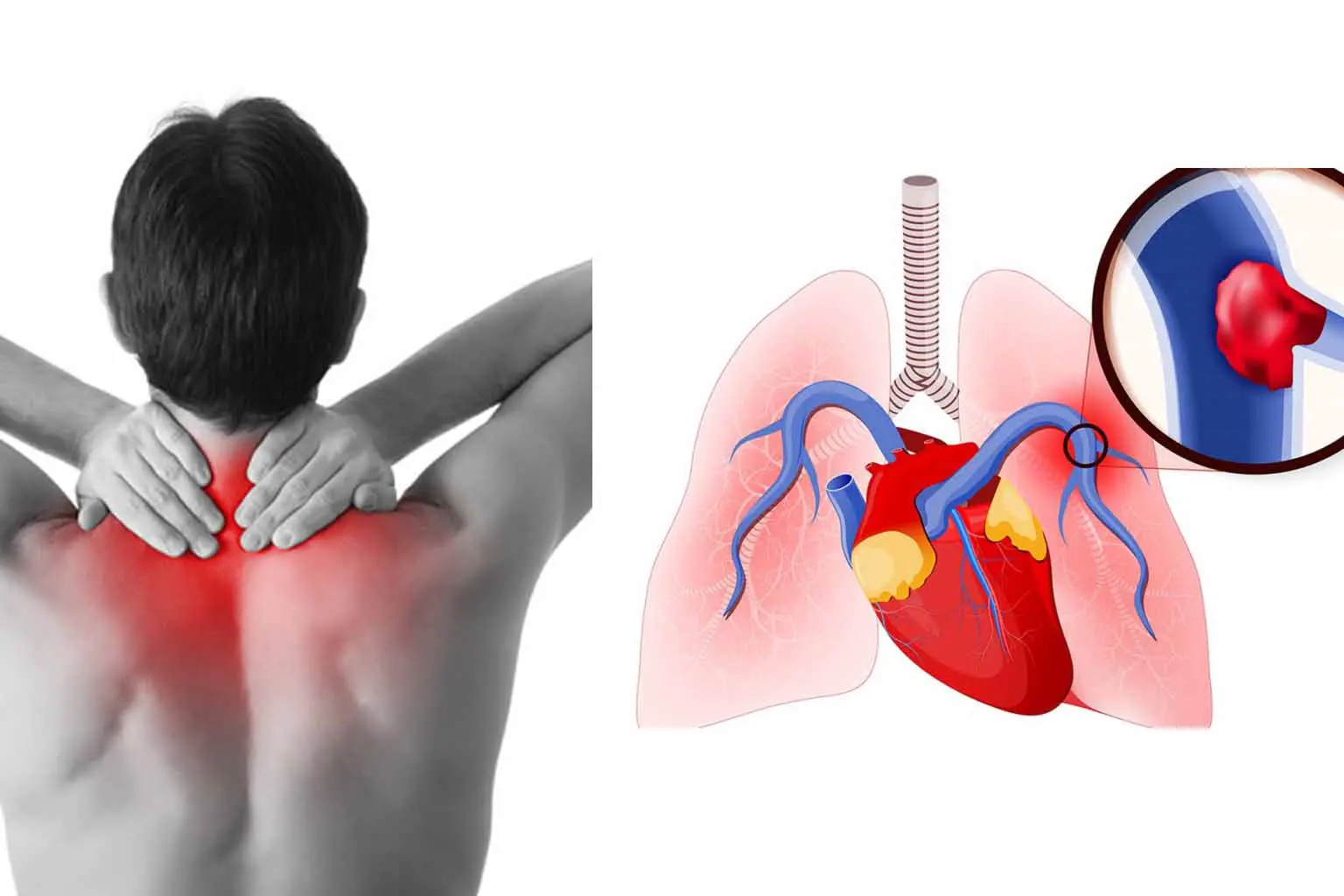 11 Alarming Causes Of Back Pain When Breathing