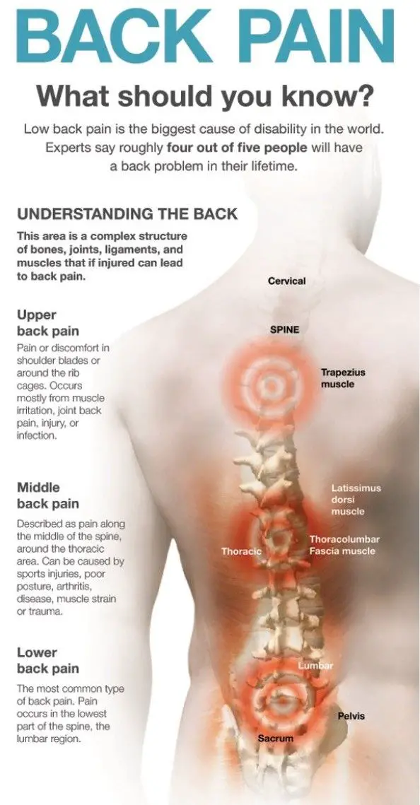 14 best Low Back Pain images on Pinterest