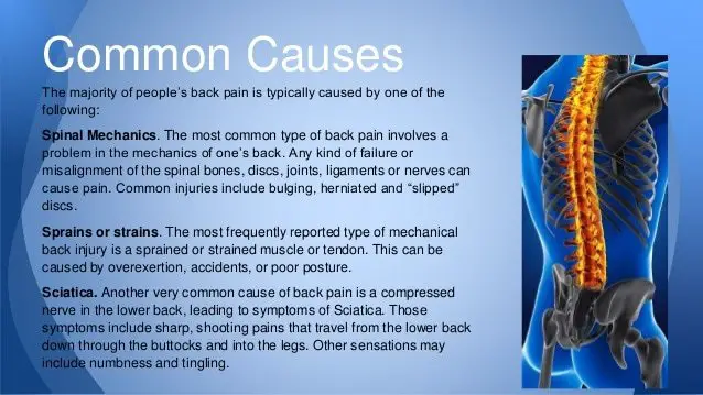 17 Common and Uncommon Back Pain Causes