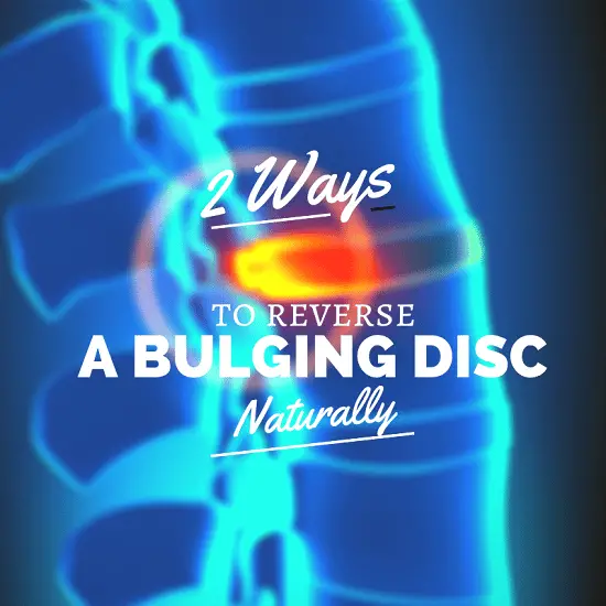 2 Powerful Ways to Reverse a Bulging Disc in Lower Back