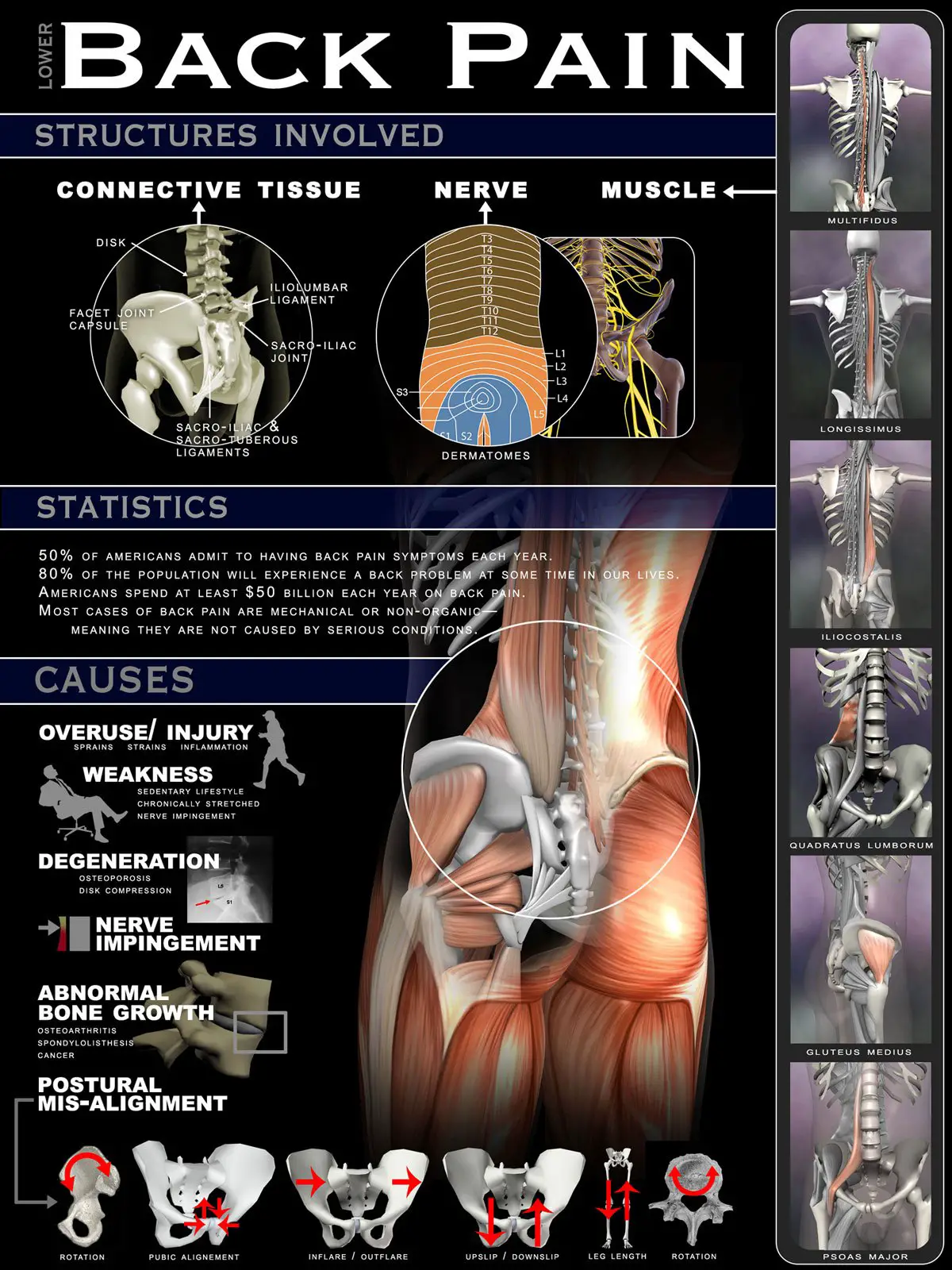 20 Interesting Infographics On Back Pain