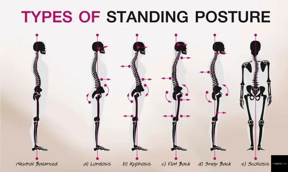 25 Exercises to Fix Bad Posture In A Few Minutes A Day
