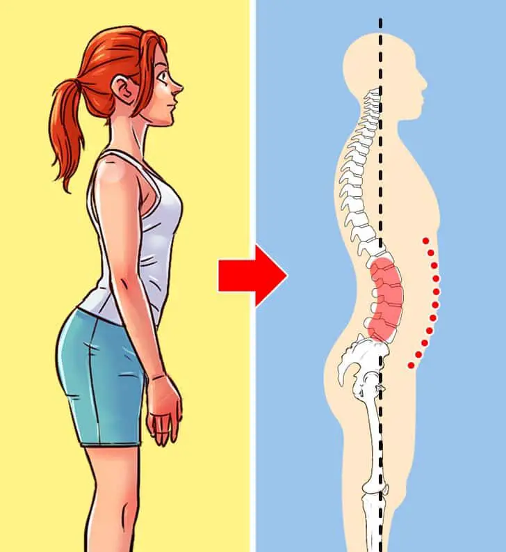 4 types of bad posture and how to correct each of them