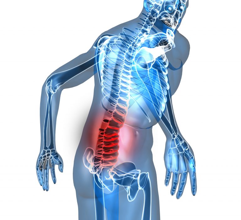 What Causes Back Pain In Men