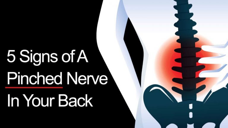 What To Do For A Pinched Nerve In Lower Back
