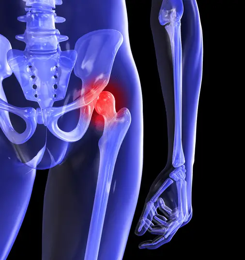 6 Reasons Why Your Back Pain Might Actually Be Caused By Your Hips