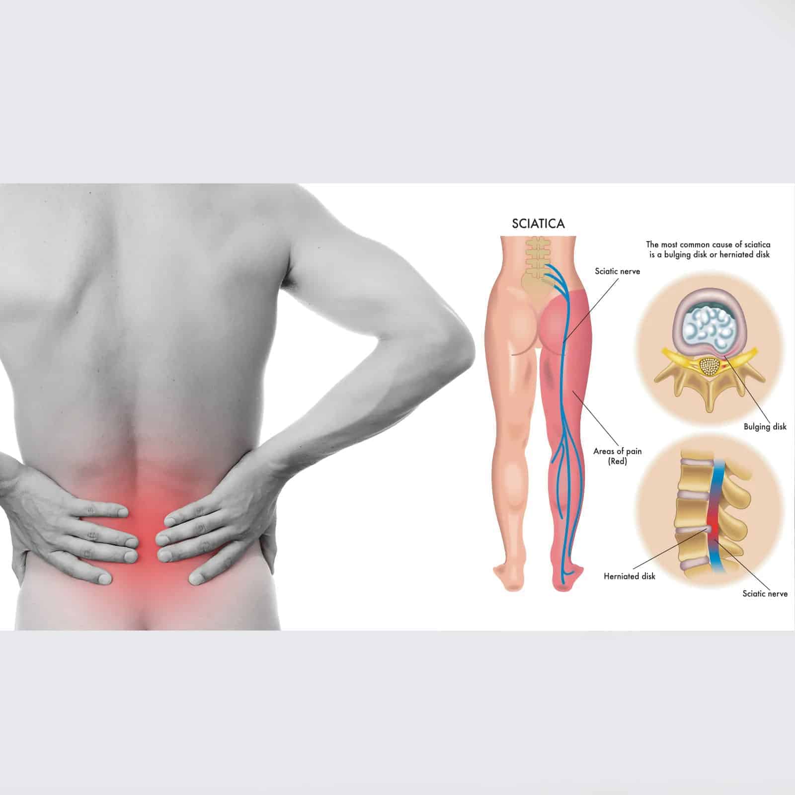 8 Sciatica Stretches to Help Prevent and Relieve Hip and Lower Back Pain