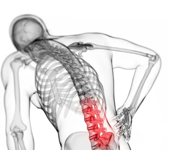 9 Causes Of Lower Back Pain