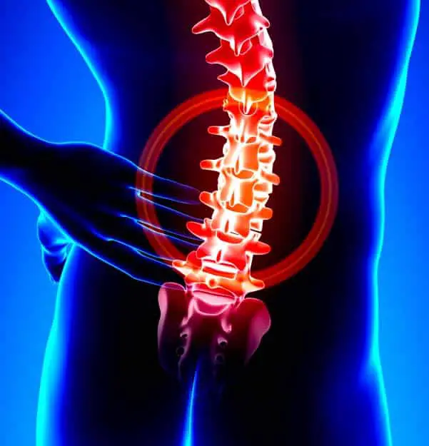 Acupuncture Alleviates Lower Back Pain and Inflammation