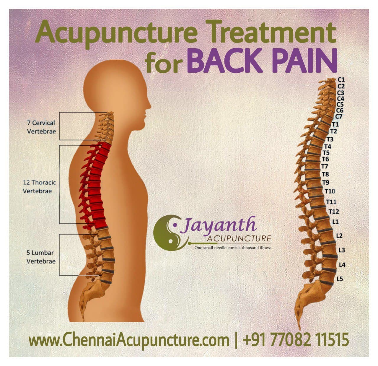 Acupuncture treatment for back pain in Chennai by expereinced ...