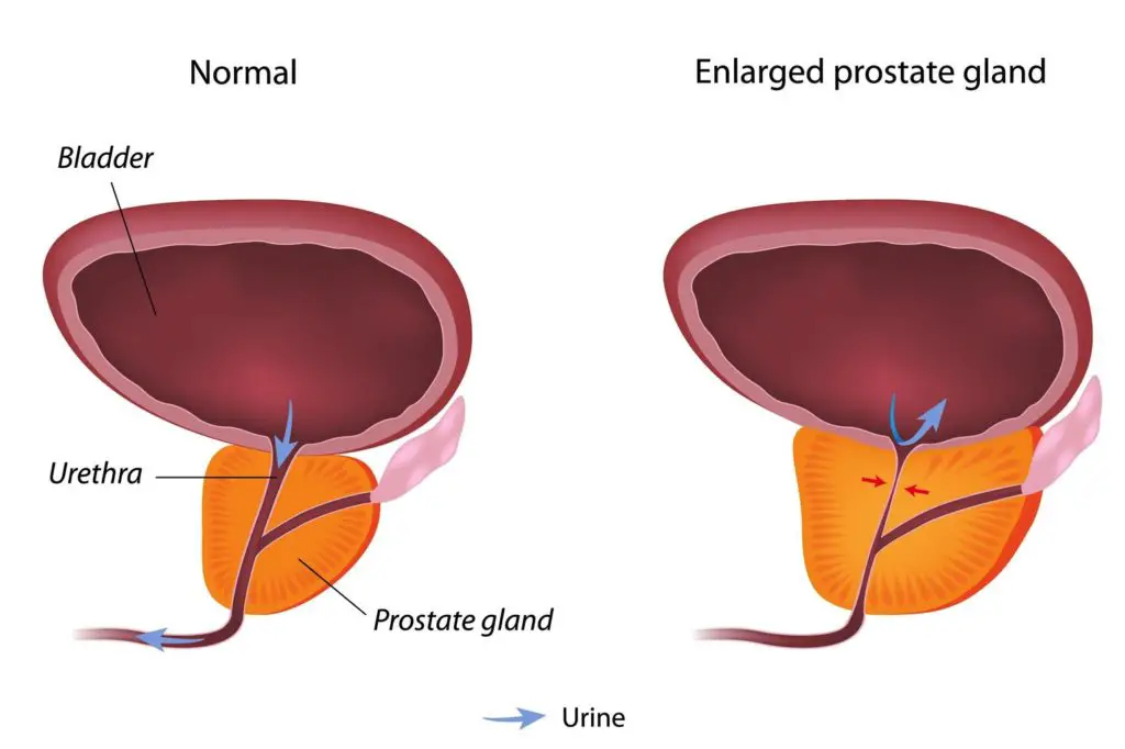 An Introduction to Prostate Health