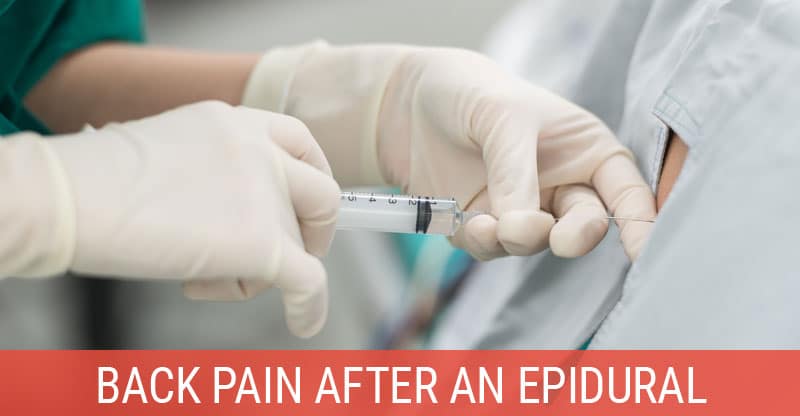 Back Pain After an Epidural Injection