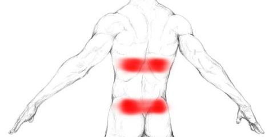 Back Pain Caused by Abdominal Trigger Points