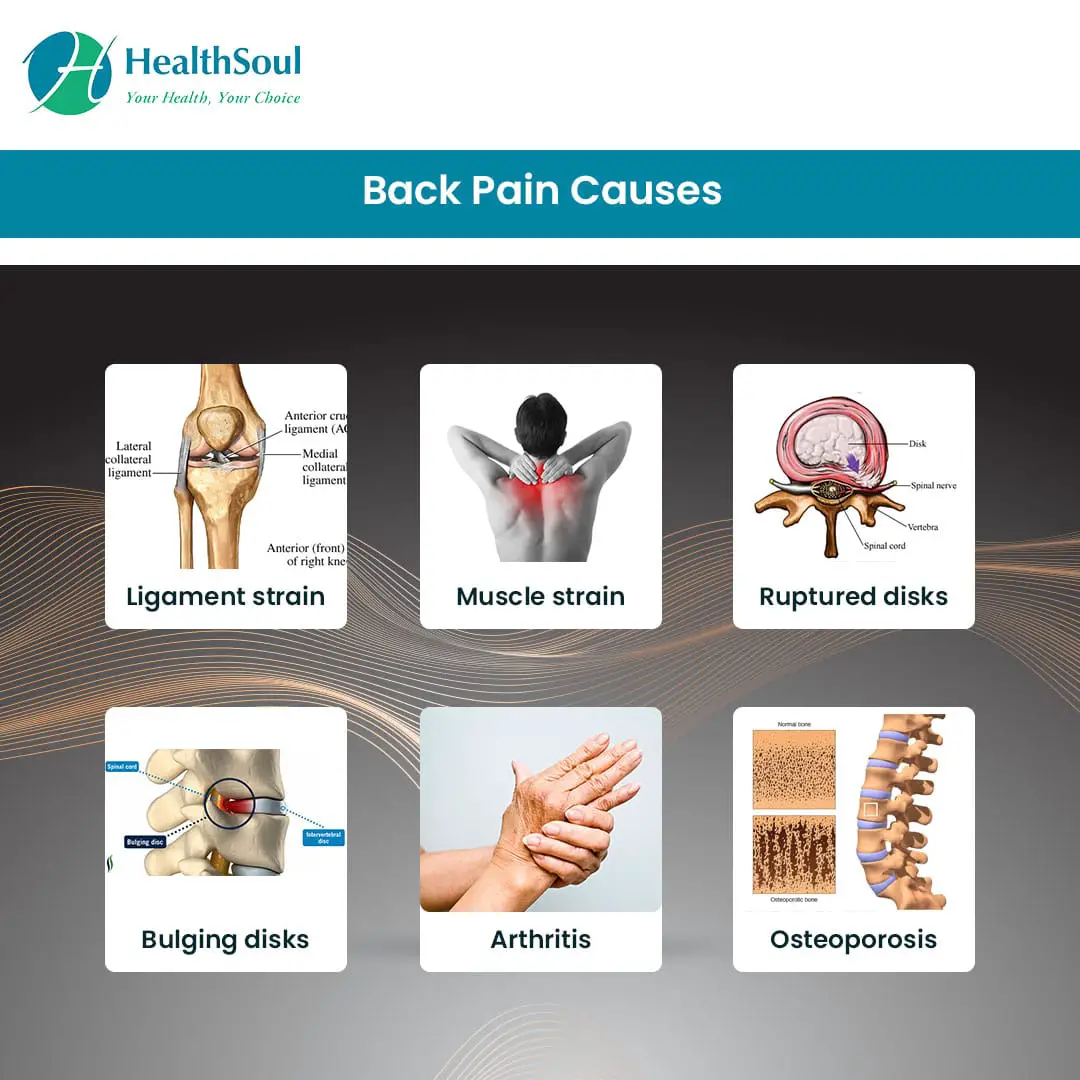 Back Pain: Causes and Symptoms â Healthsoul