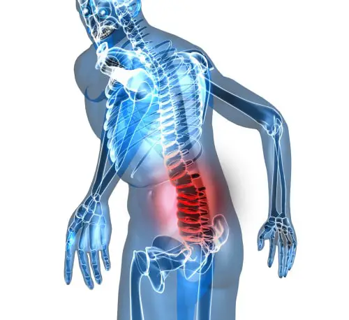 Back Pain: Causes, Symptoms and Impact