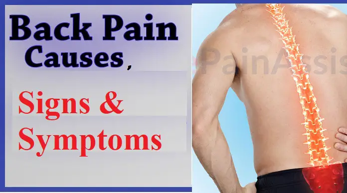 Back Pain Common Causes, Signs &  Symptoms