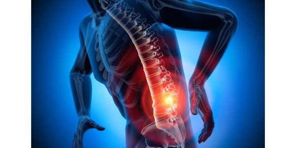 Back Pain May Qualify for Social Security Disability ...