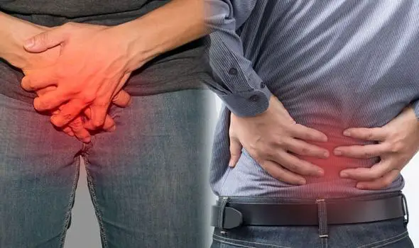Back pain: One unusual cause of the condition