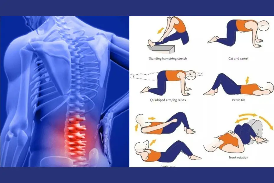 Bid Goodbye to Lower Back Pain With These 5 Exercises