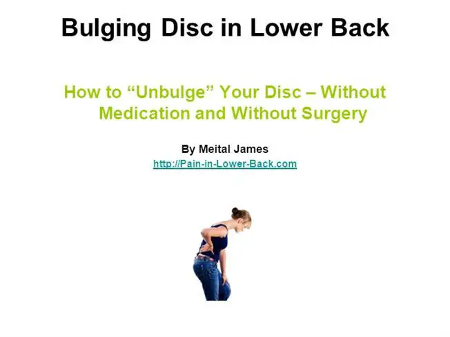 Bulging Disc in Lower Back Natural Treatments Ppt Presentation
