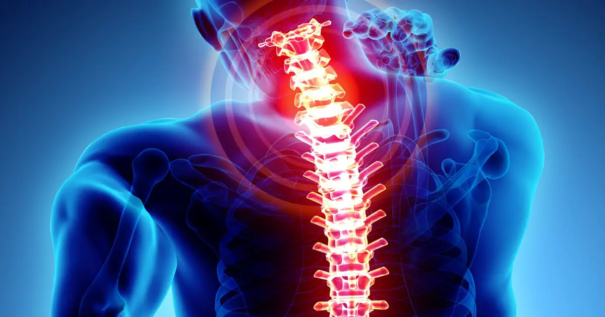 Can You Collect Social Security Disability for Back Pain?