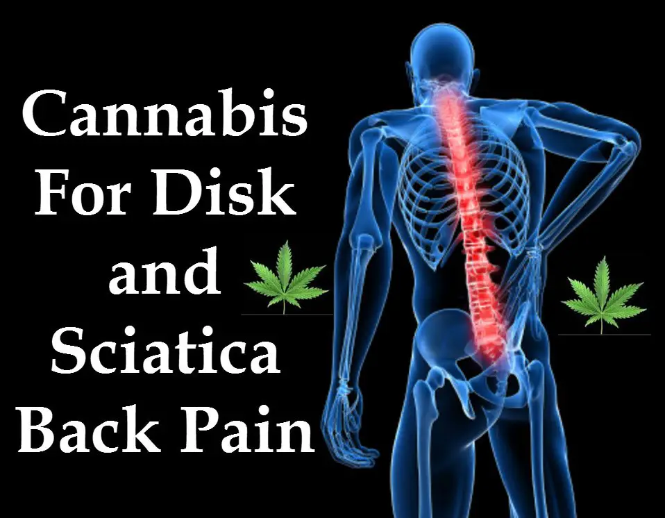 Cannabis For Disk and Sciatica Back Pain