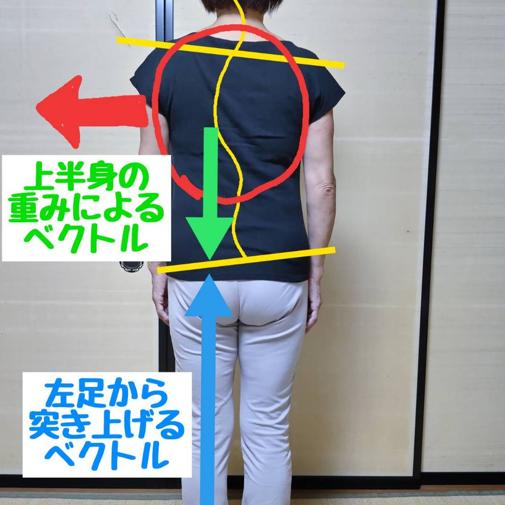 Case study / lower back pain(2) ~pain appeared after exercising~
