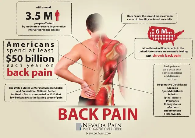 CBD For Scoliosis Pain  Increased Pressure On The Spinal Disc