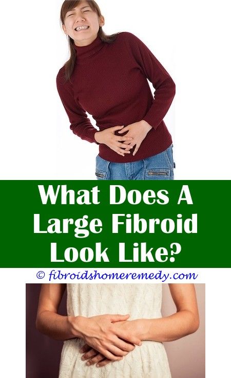 Chinese Medicine For Fibroids