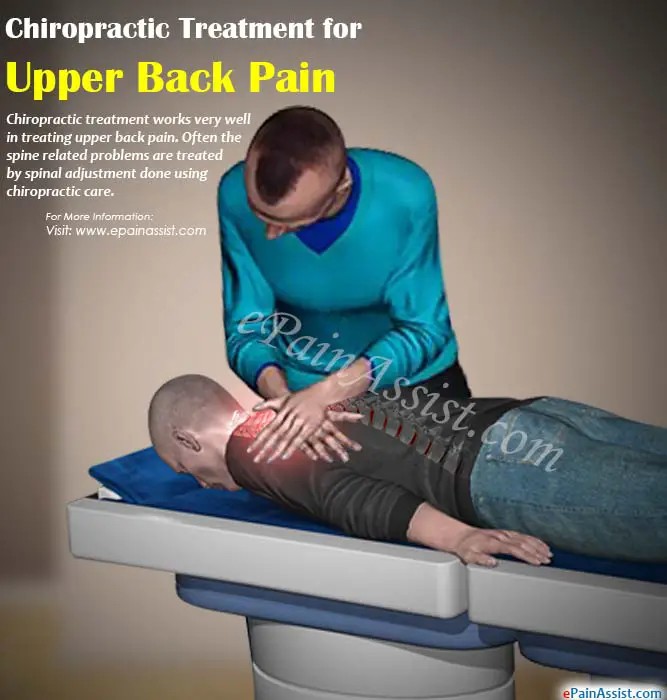 Chiropractic Treatment for Upper Back Pain