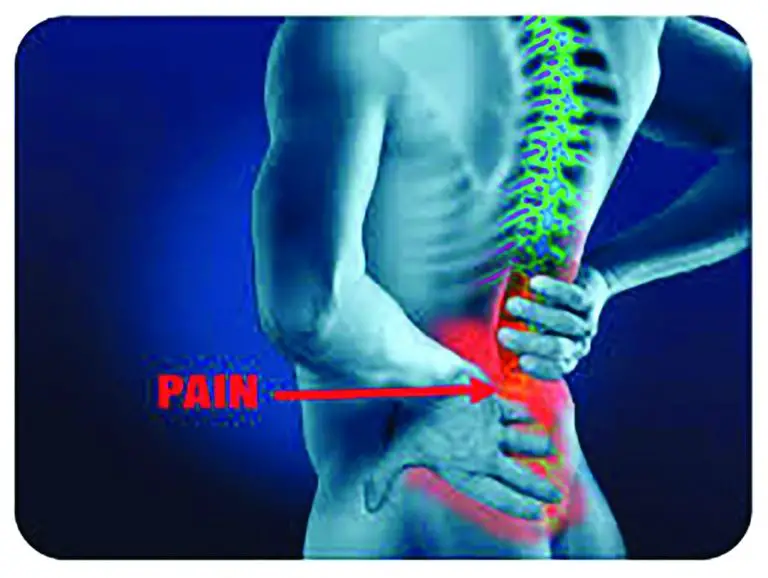 When Is Lower Back Pain Serious