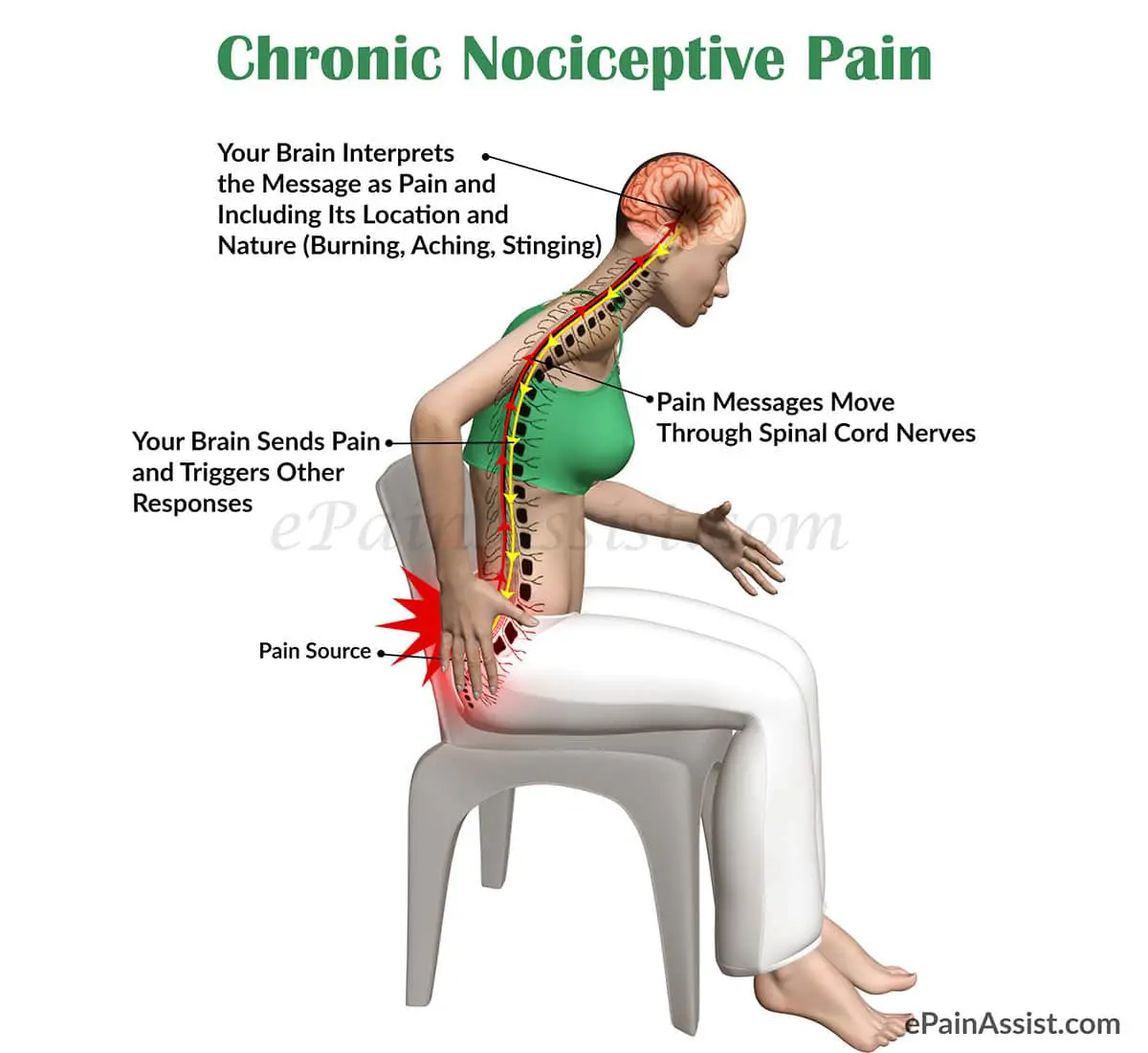 Chronic Nociceptive Pain