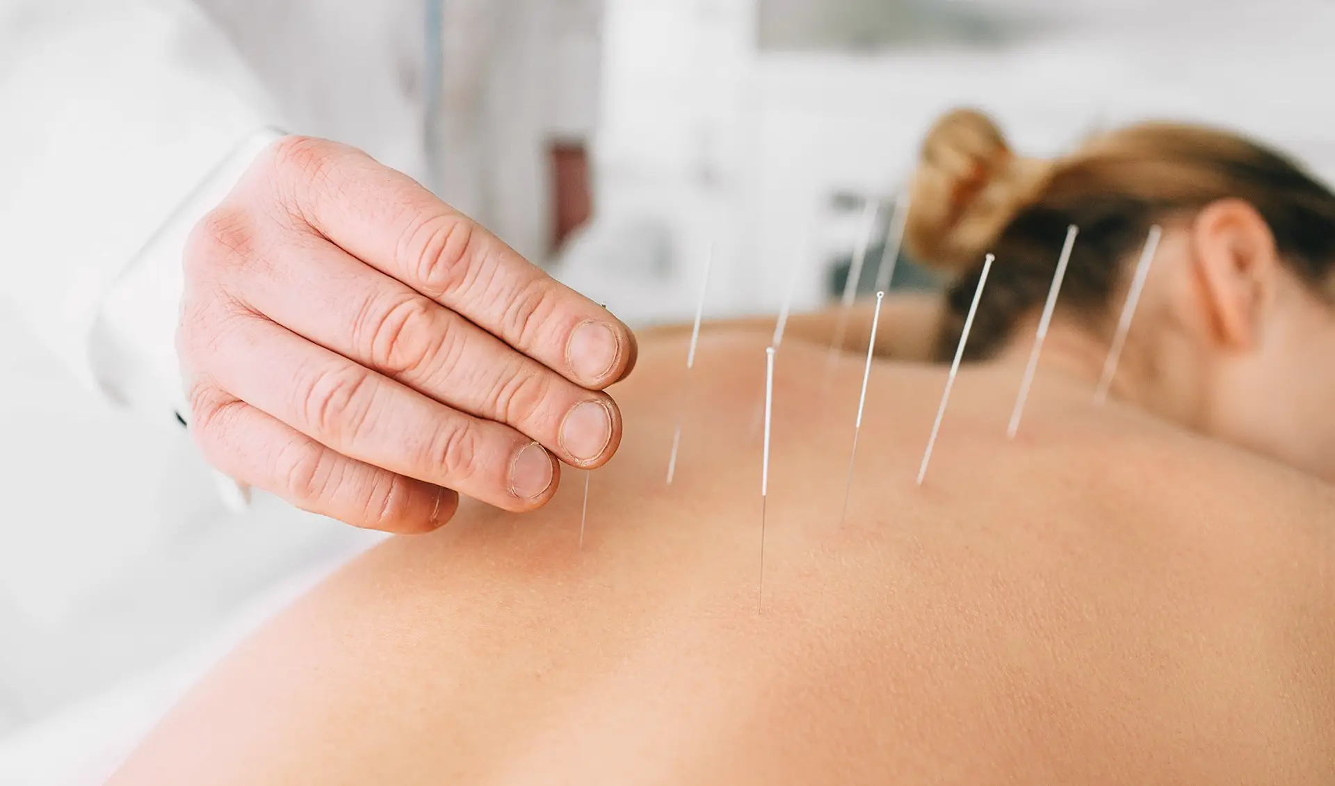 Could Acupunture Ease Your Back And Joint Pains?