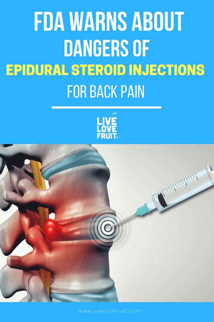 FDA Warns About Dangers of Epidural Steroid Injections for Back Pain ...