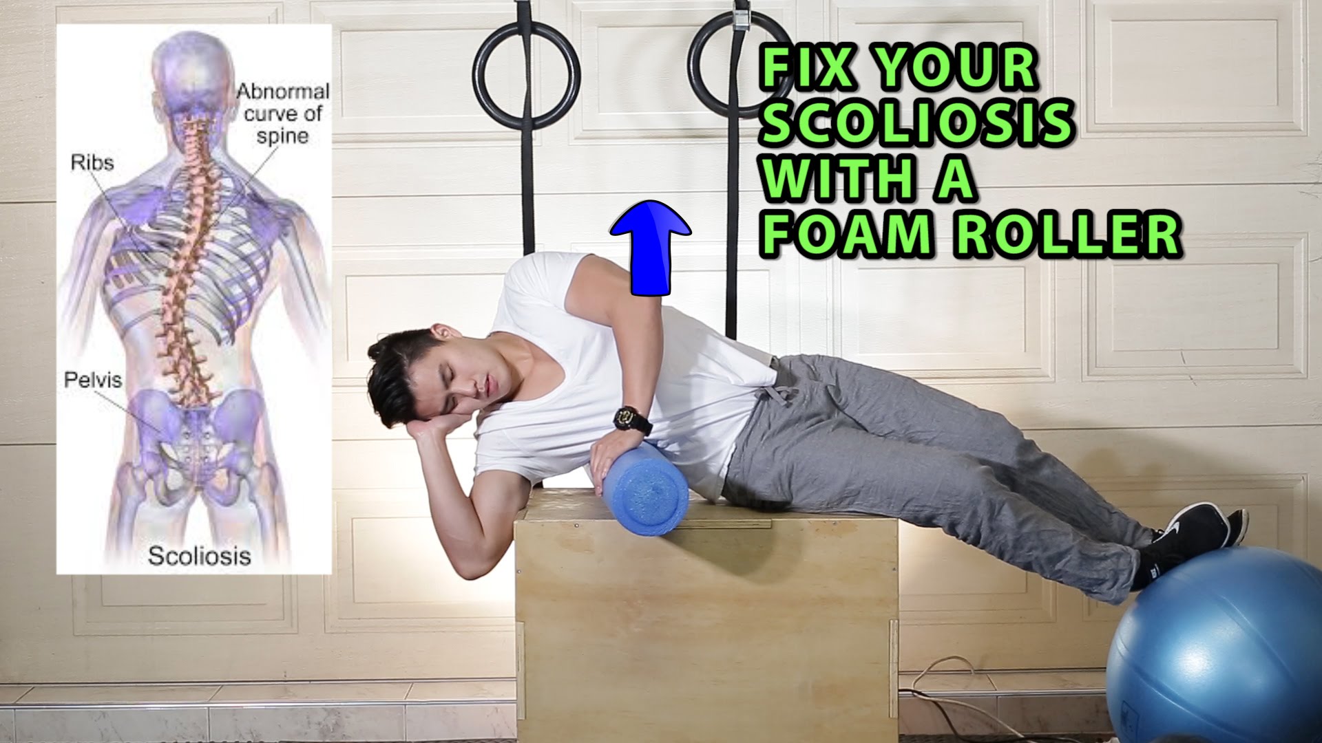 Fix Your Scoliosis with a Foam Roller (Scroth