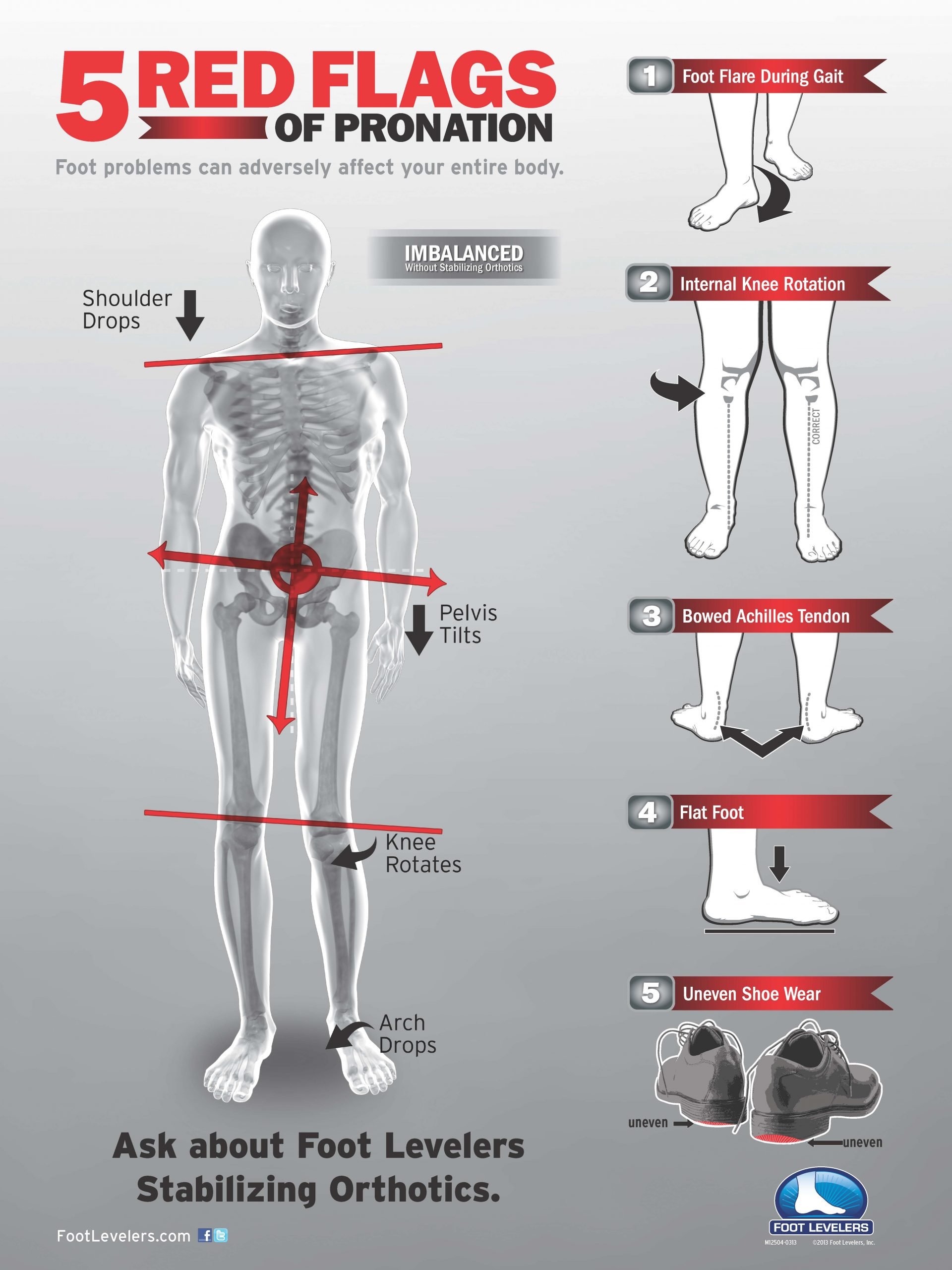 Foot Orthotics Along with Chiropractic Help Low Back Pain ...