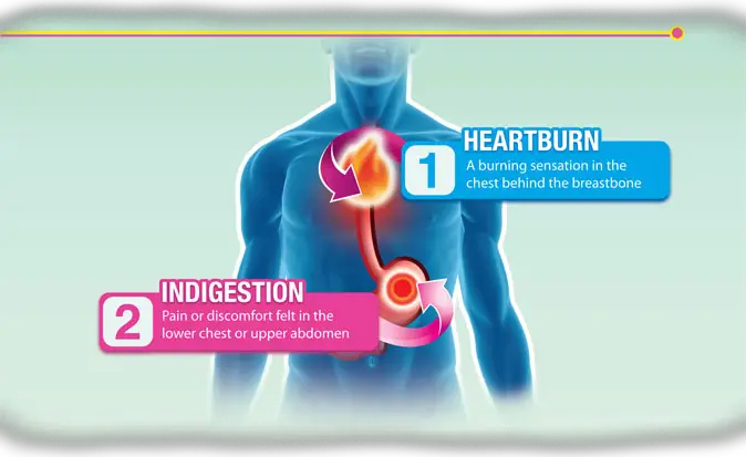 Gaviscon: What to do when you suffer from heartburn or ...