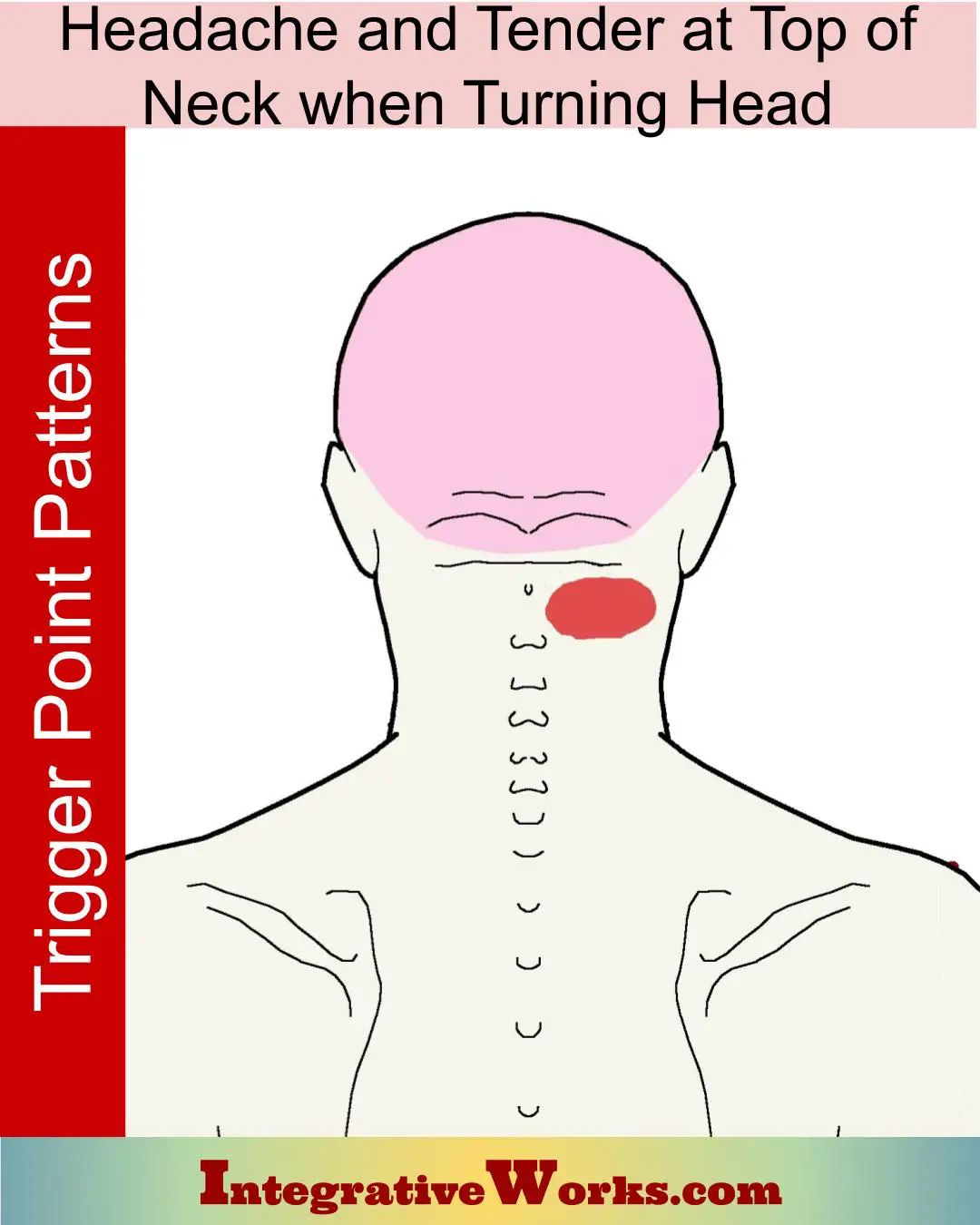 Headache with Tender Top of Neck While Turning ...