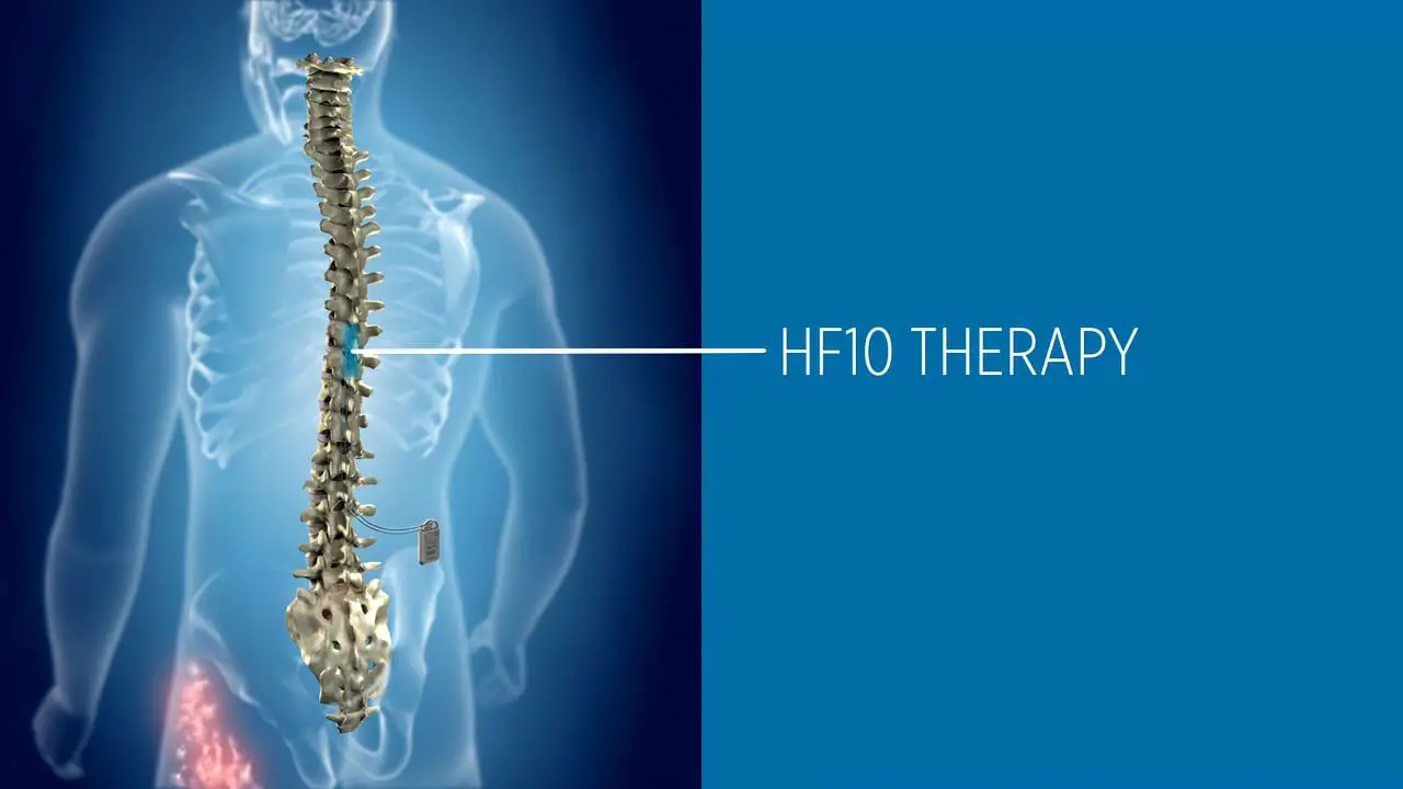 HF10 Therapy Product and Procedure Overview