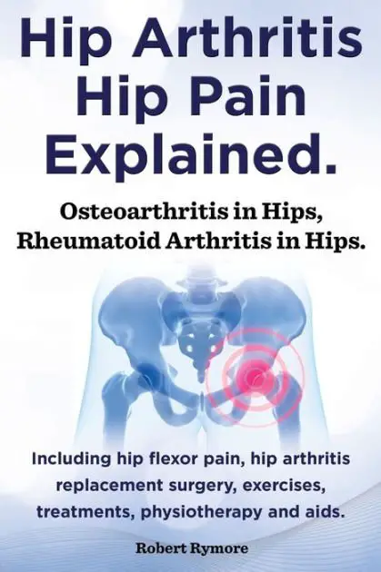 Hip Arthritis, Hip Pain Explained. Osteoarthritis in Hips ...