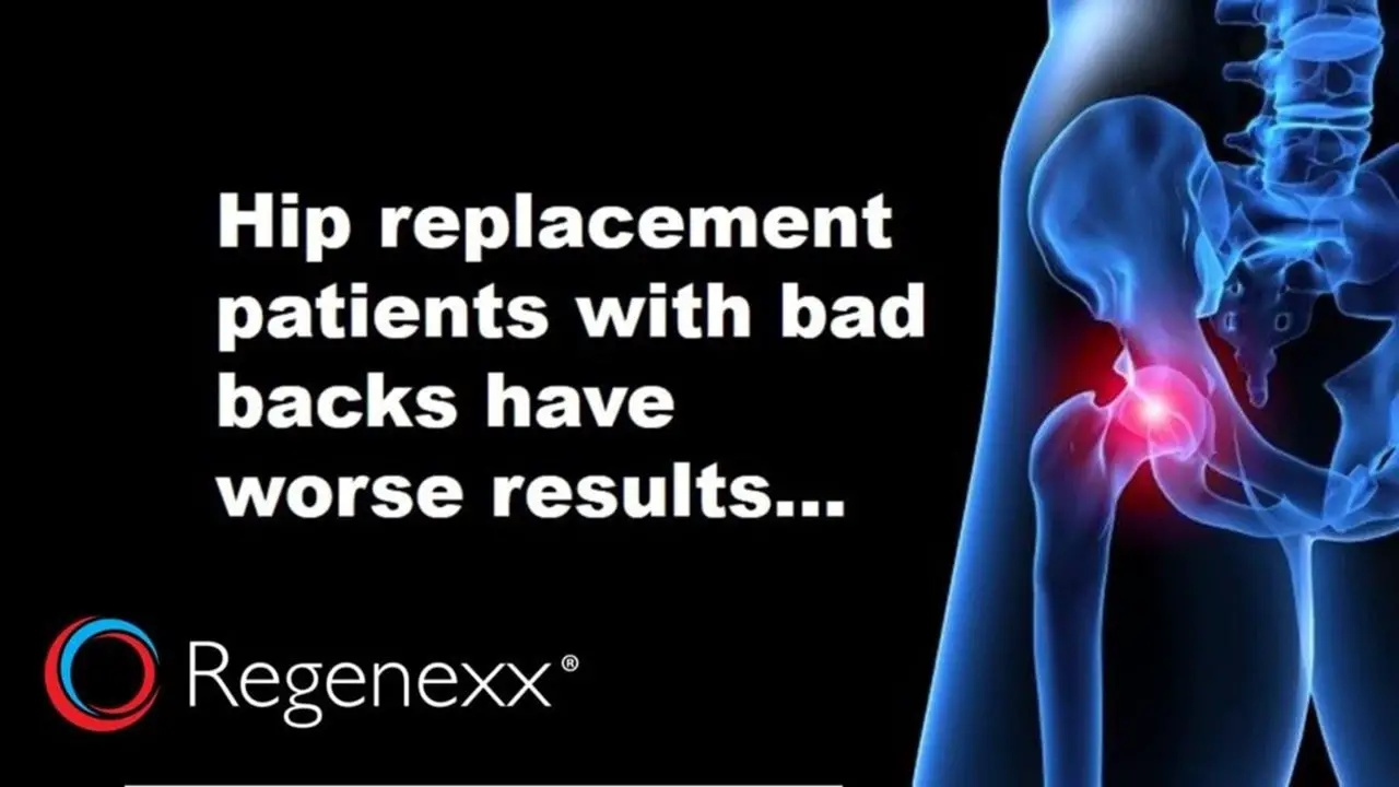 Hip Replacement Back Pain? How Many Hips that Don
