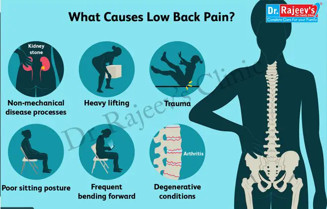 Homeopathy Treatment for LOW BACK PAIN OR LUMBAGO