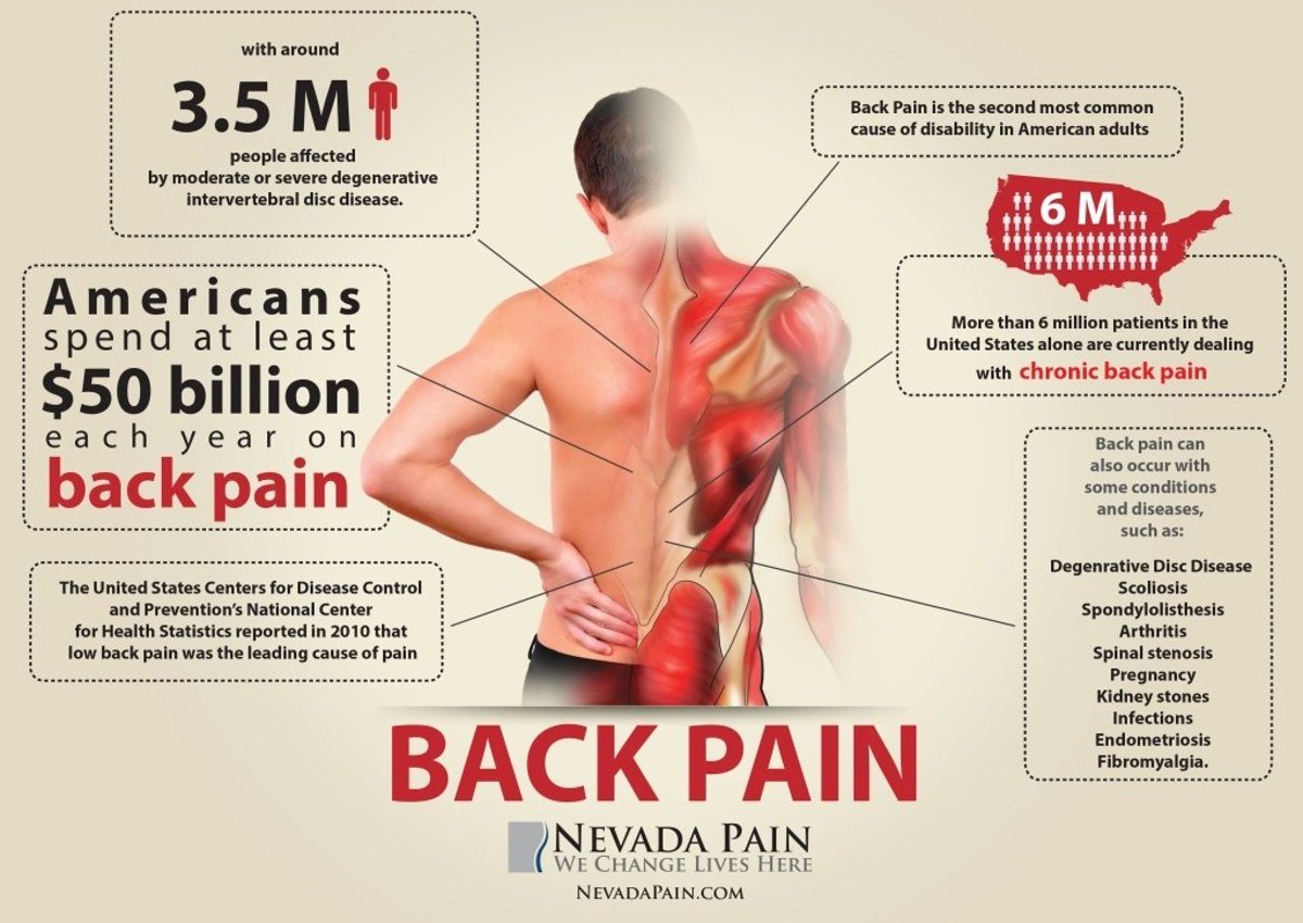 How I Treated My Back Pain and Injury