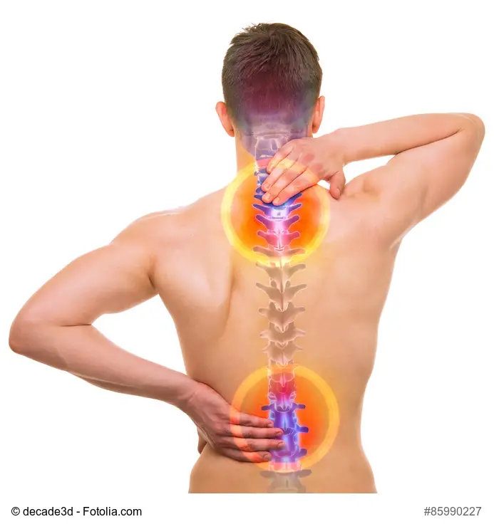 How To Fix A Pinched Nerve In Back Fast