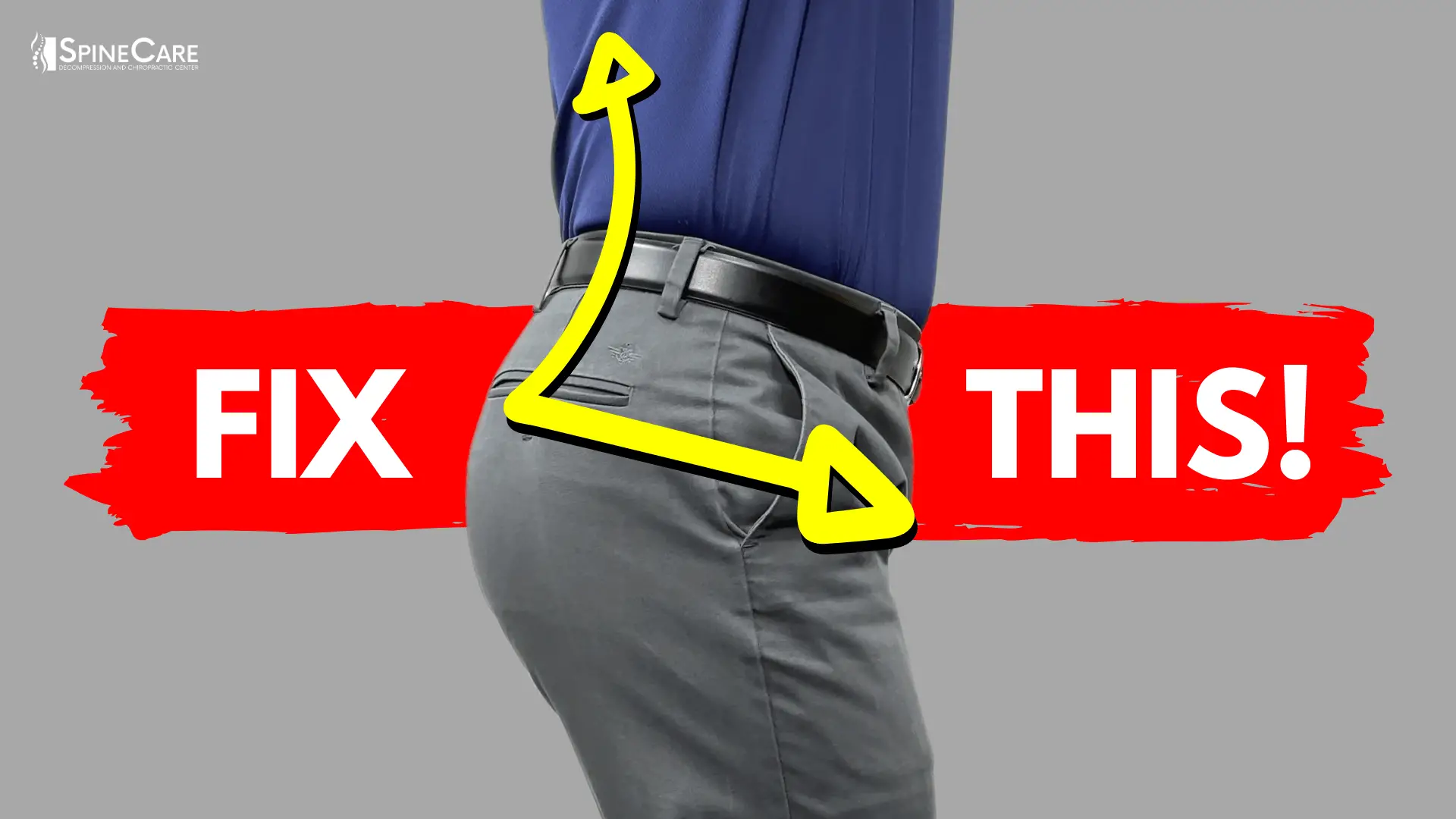 How to Fix Bad Lower Back Posture for Good