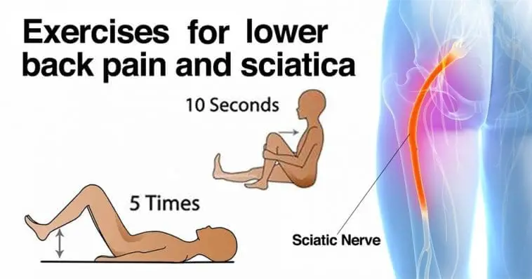 How to Release a Pinched Nerve in the Lumbar Area (Sciatica)  2 Simple ...