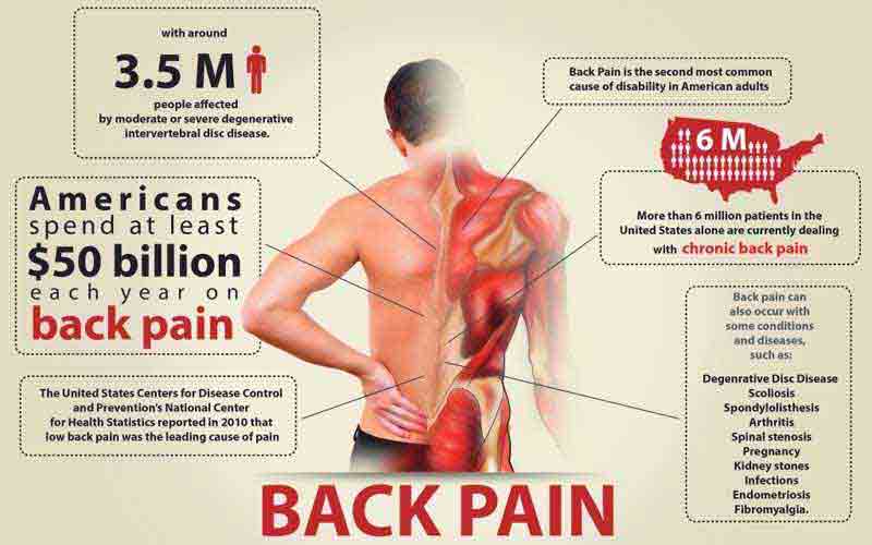 How To Treat Upper and Middle Back Pain?