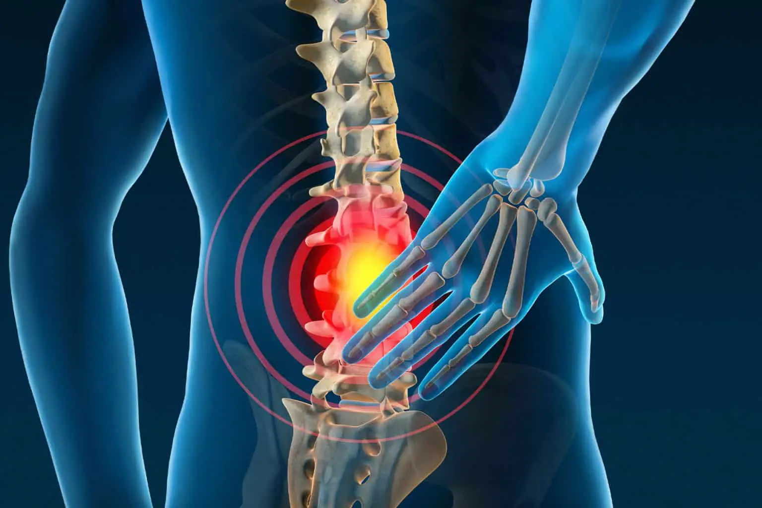 Is Chiropractic Care Effective for Back Pain?