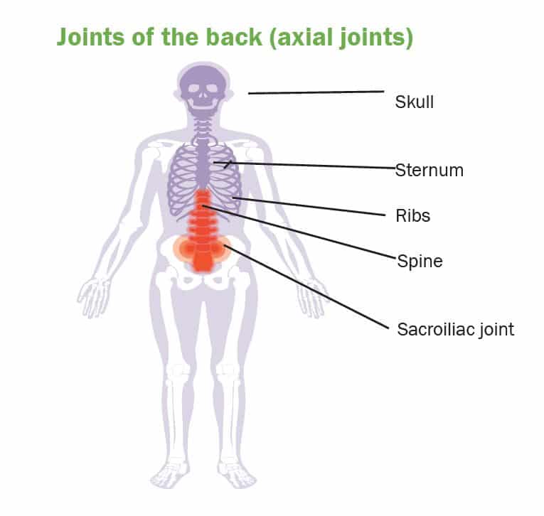 Joints and Crohn